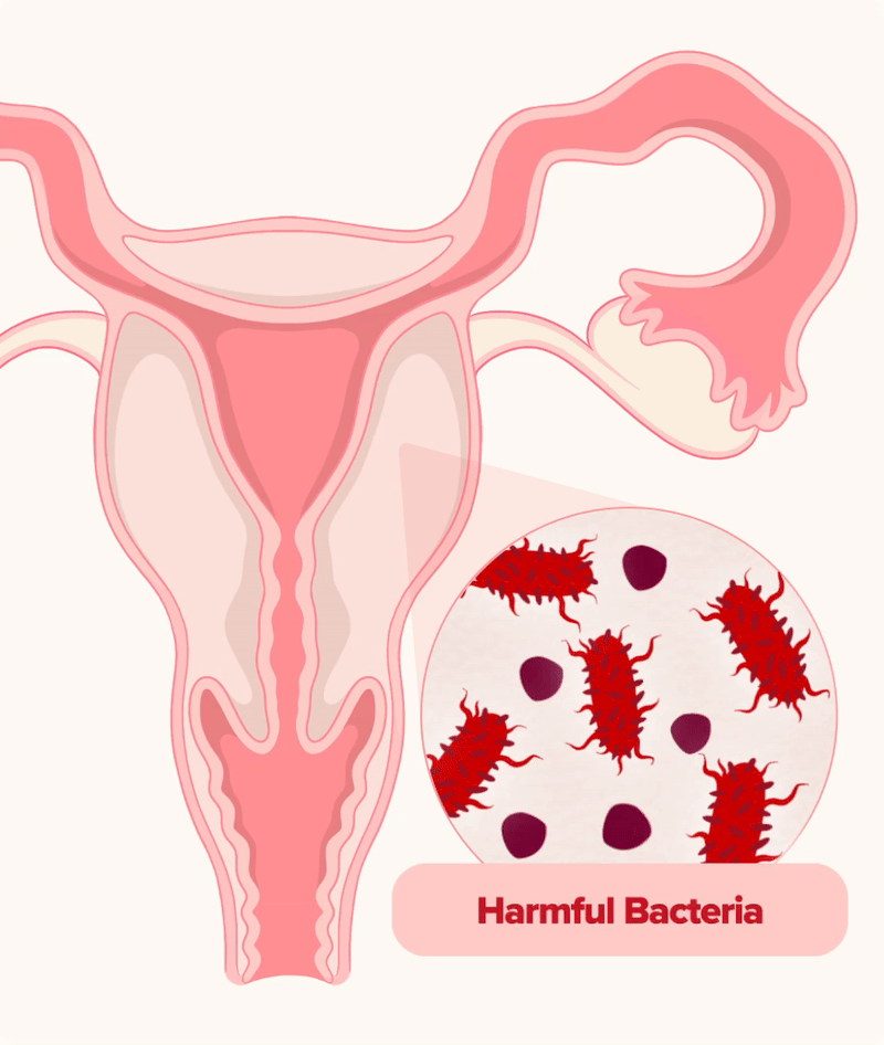 Vaginal Probiotic